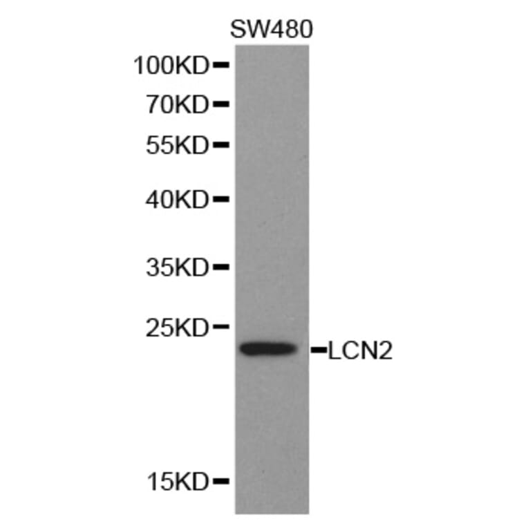 Western blot - LCN2 antibody from Signalway Antibody (38356) - Antibodies.com