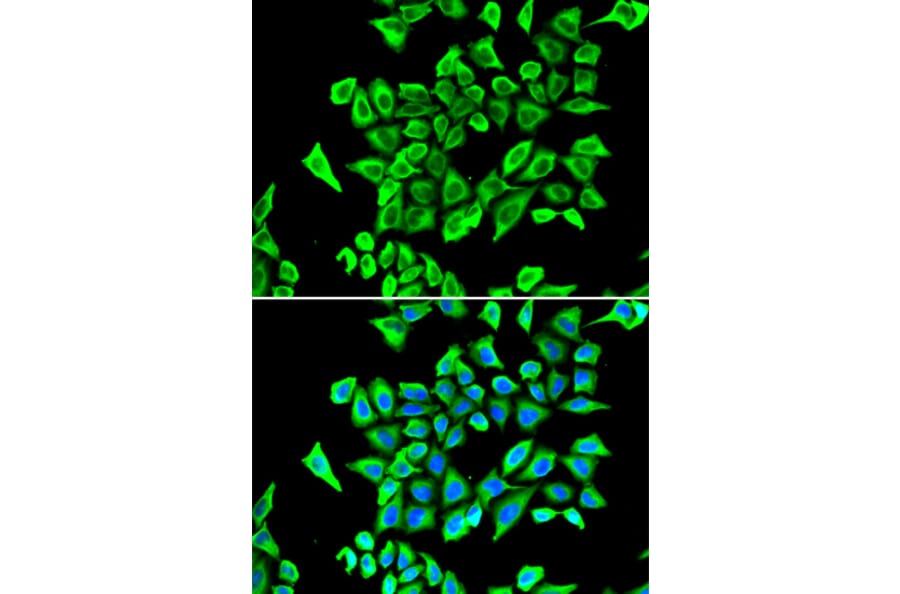 Immunofluorescence - LCN2 antibody from Signalway Antibody (38356) - Antibodies.com