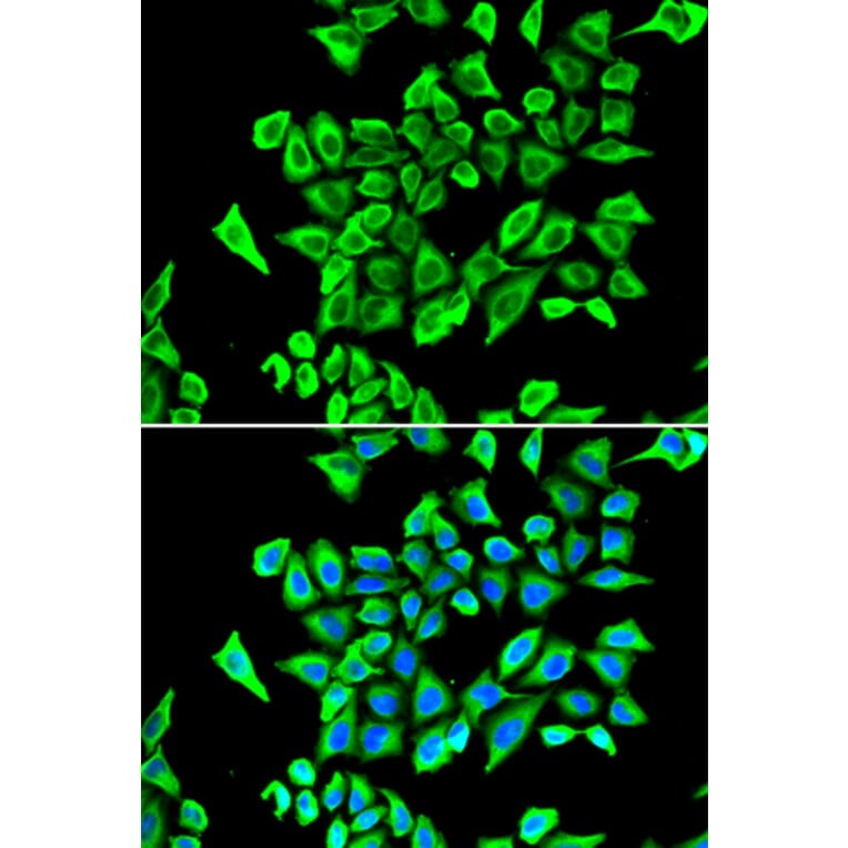 Immunofluorescence - LCN2 antibody from Signalway Antibody (38356) - Antibodies.com