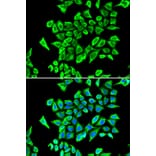 Immunofluorescence - LCN2 antibody from Signalway Antibody (38356) - Antibodies.com
