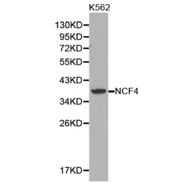 Western blot - NCF4 antibody from Signalway Antibody (38360) - Antibodies.com