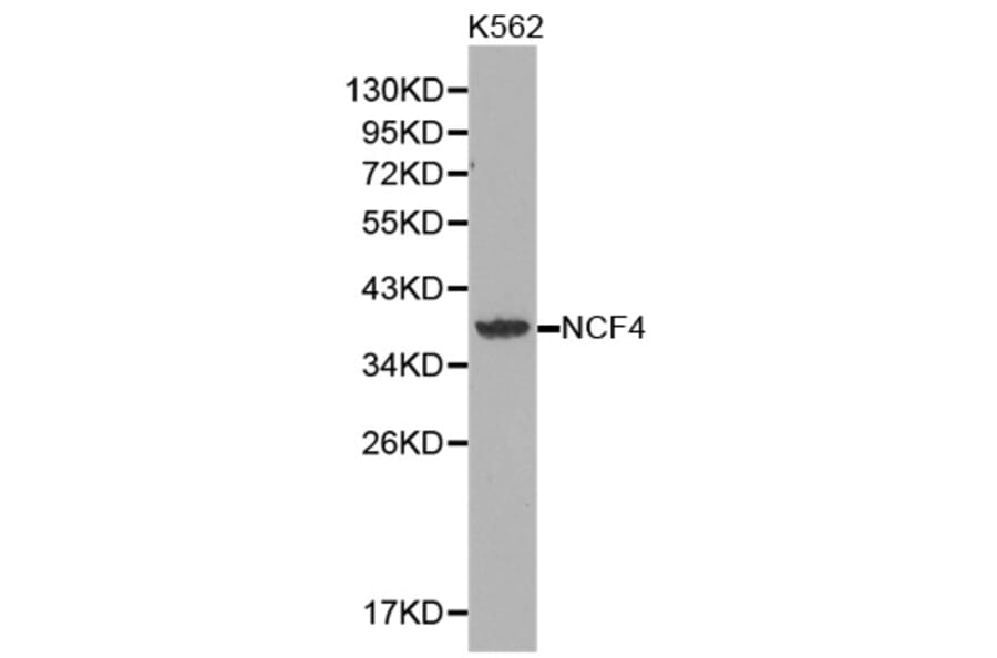 Western blot - NCF4 antibody from Signalway Antibody (38360) - Antibodies.com