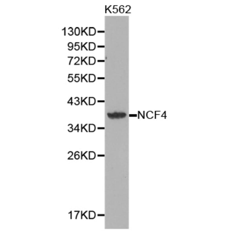 Western blot - NCF4 antibody from Signalway Antibody (38360) - Antibodies.com