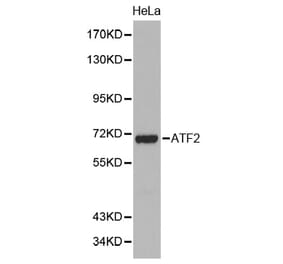 Western blot - ATF2 antibody from Signalway Antibody (38387) - Antibodies.com
