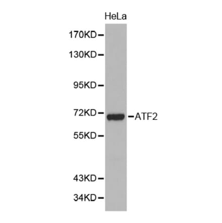Western blot - ATF2 antibody from Signalway Antibody (38387) - Antibodies.com