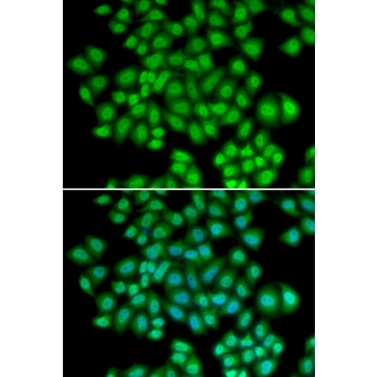 Immunofluorescence - ATF2 antibody from Signalway Antibody (38387) - Antibodies.com