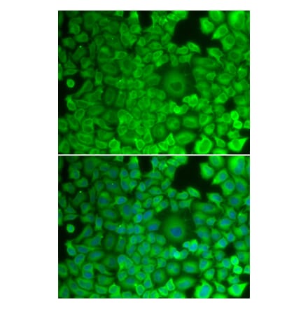 Immunofluorescence - GYS1 antibody from Signalway Antibody (38415) - Antibodies.com