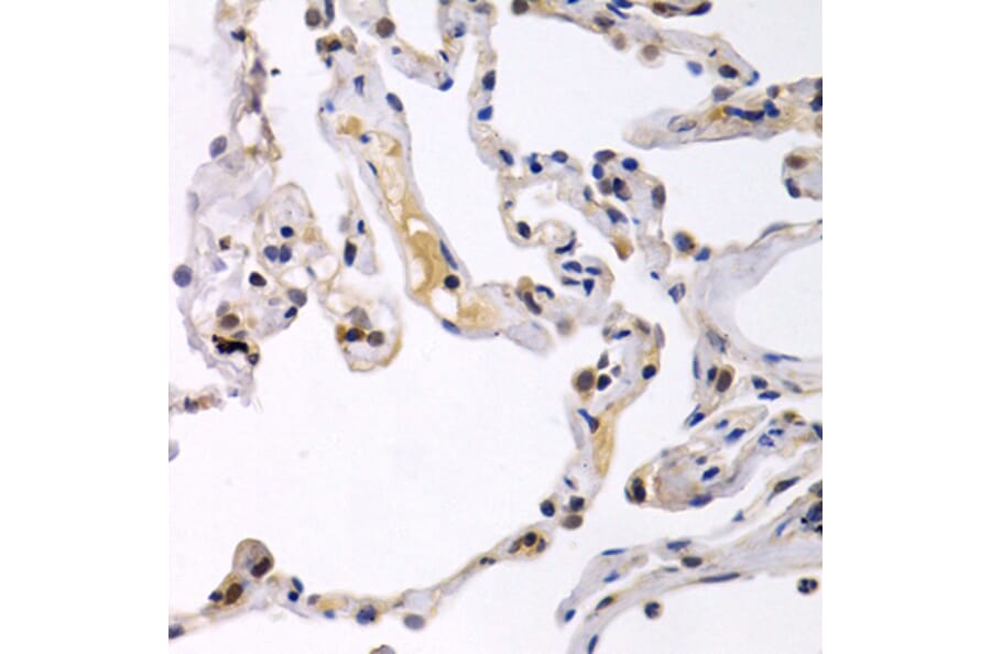 Immunohistochemistry - OAS1 antibody from Signalway Antibody (38417) - Antibodies.com
