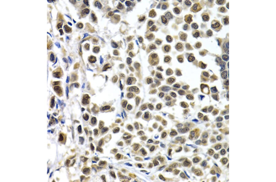 Immunohistochemistry - IRF2 antibody from Signalway Antibody (38426) - Antibodies.com