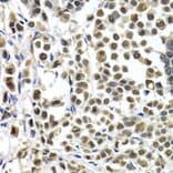 Immunohistochemistry - IRF2 antibody from Signalway Antibody (38426) - Antibodies.com