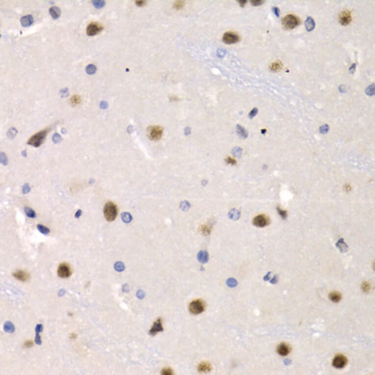 Immunohistochemistry - IRF2 antibody from Signalway Antibody (38426) - Antibodies.com