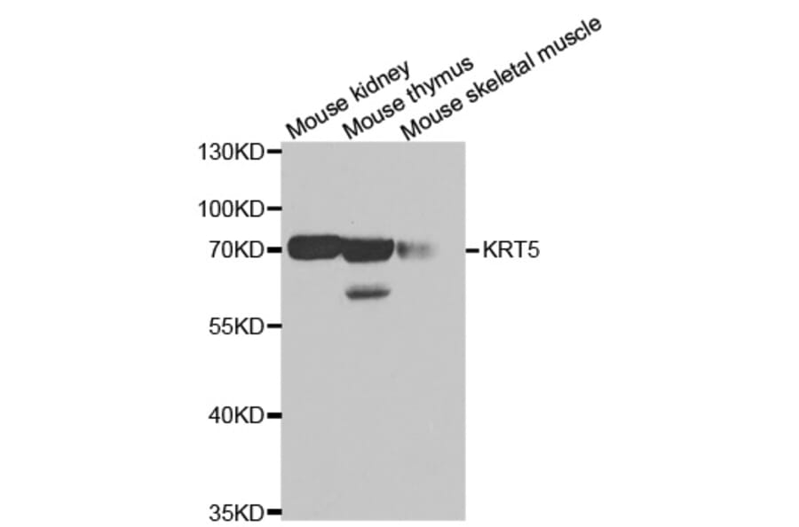 Western blot - KRT5 antibody from Signalway Antibody (38435) - Antibodies.com