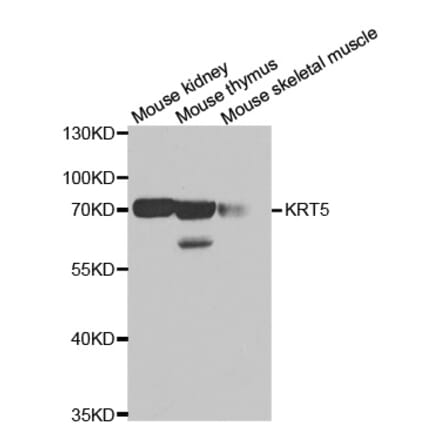 Western blot - KRT5 antibody from Signalway Antibody (38435) - Antibodies.com