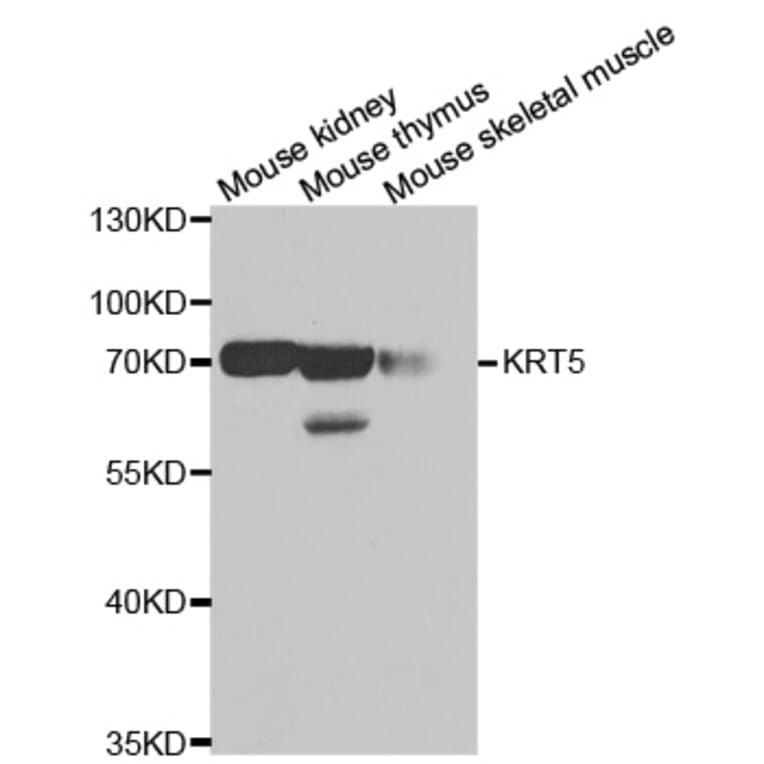 Western blot - KRT5 antibody from Signalway Antibody (38435) - Antibodies.com
