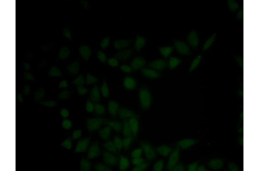 Immunofluorescence - KRT5 antibody from Signalway Antibody (38435) - Antibodies.com
