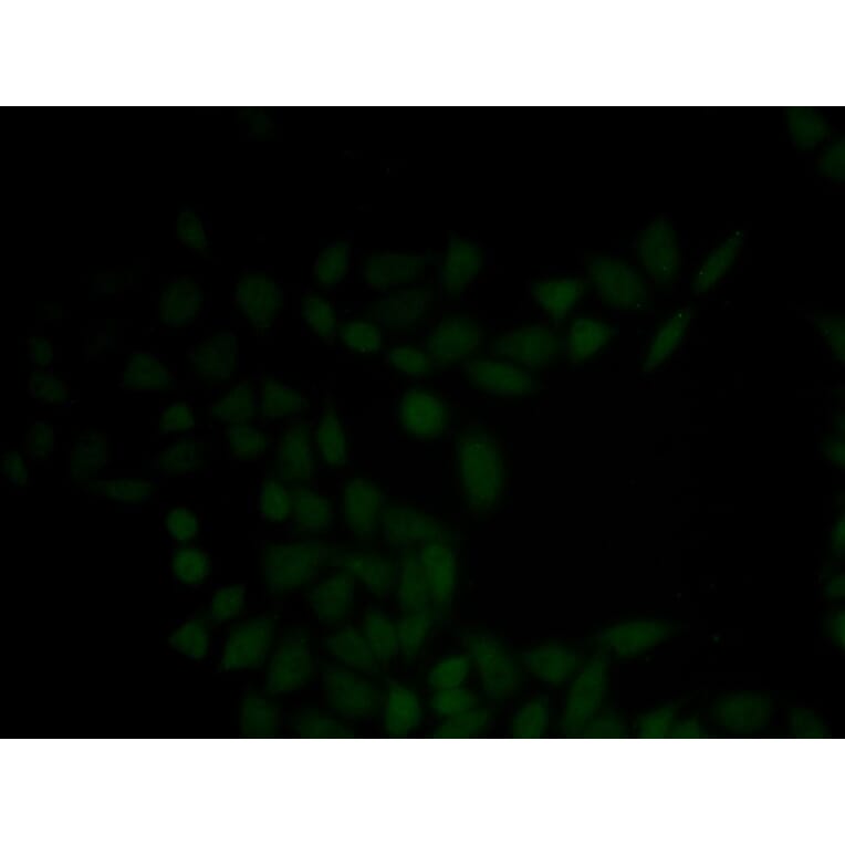 Immunofluorescence - KRT5 antibody from Signalway Antibody (38435) - Antibodies.com