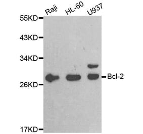 Western blot - BCL2 antibody from Signalway Antibody (38472) - Antibodies.com