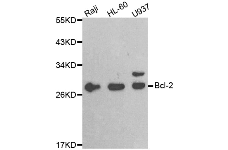 Western blot - BCL2 antibody from Signalway Antibody (38472) - Antibodies.com