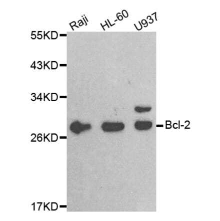 Western blot - BCL2 antibody from Signalway Antibody (38472) - Antibodies.com