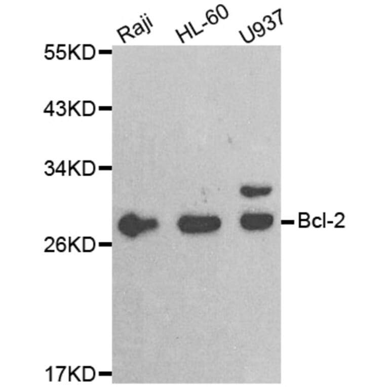Western blot - BCL2 antibody from Signalway Antibody (38472) - Antibodies.com