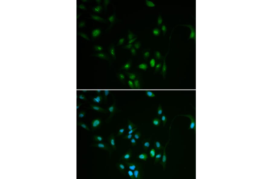 Immunofluorescence - BCL2 antibody from Signalway Antibody (38472) - Antibodies.com