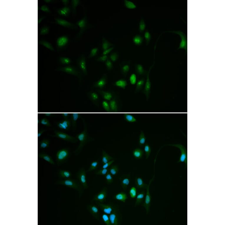 Immunofluorescence - BCL2 antibody from Signalway Antibody (38472) - Antibodies.com