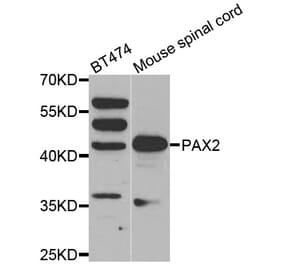 Western blot - PAX2 antibody from Signalway Antibody (38561) - Antibodies.com