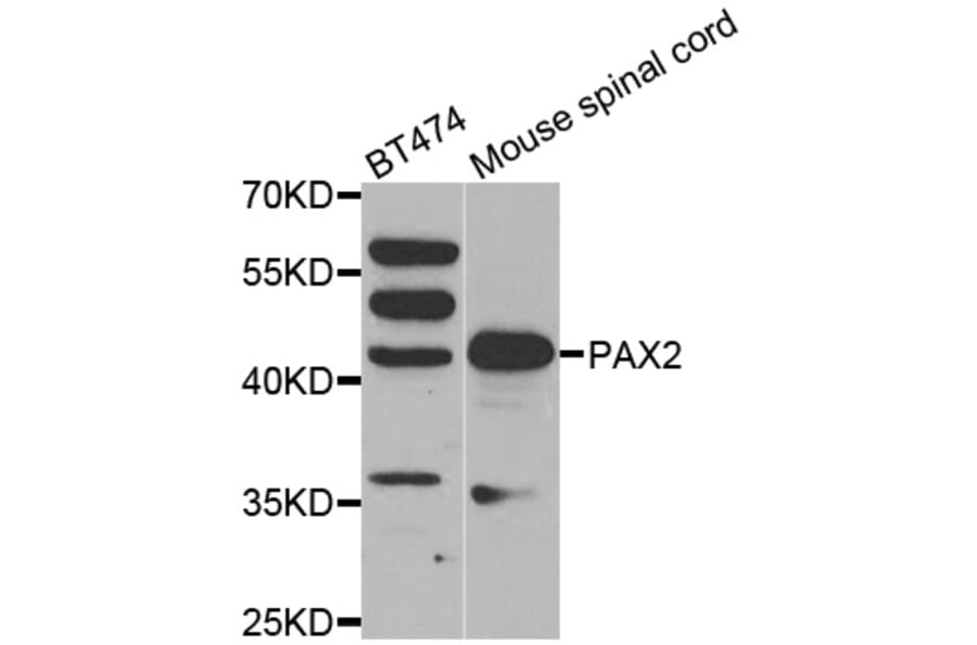 Western blot - PAX2 antibody from Signalway Antibody (38561) - Antibodies.com