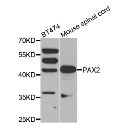 Western blot - PAX2 antibody from Signalway Antibody (38561) - Antibodies.com