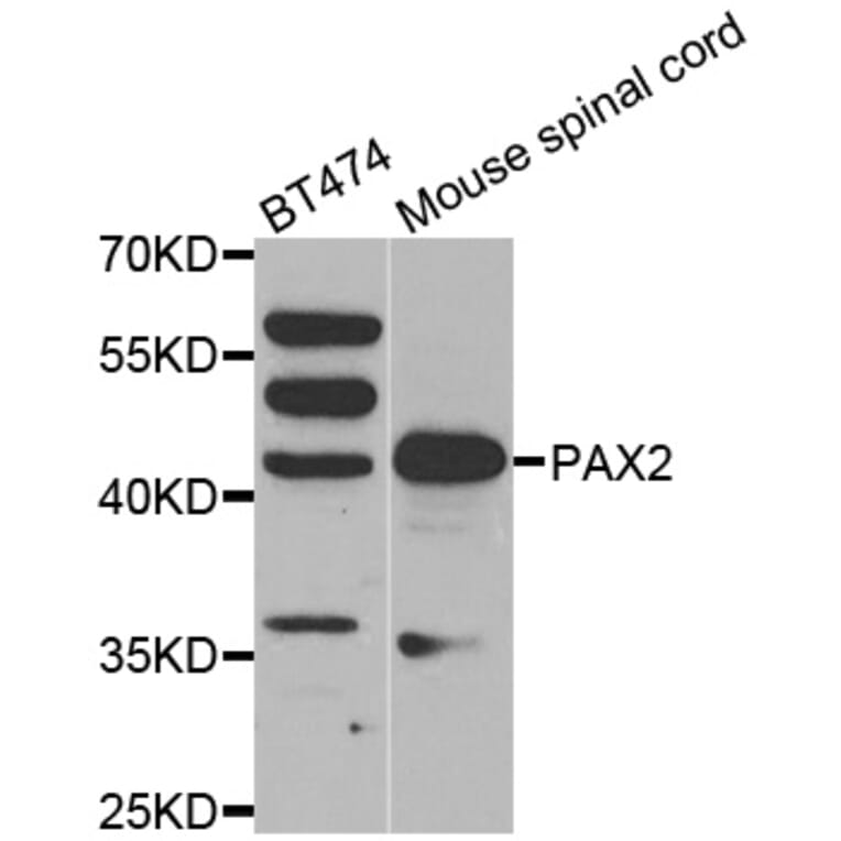 Western blot - PAX2 antibody from Signalway Antibody (38561) - Antibodies.com