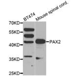 Western blot - PAX2 antibody from Signalway Antibody (38561) - Antibodies.com