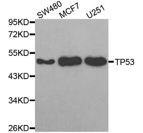 Western blot - TP53 antibody from Signalway Antibody (38624) - Antibodies.com