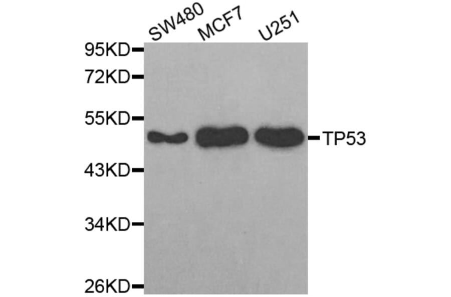 Western blot - TP53 antibody from Signalway Antibody (38624) - Antibodies.com