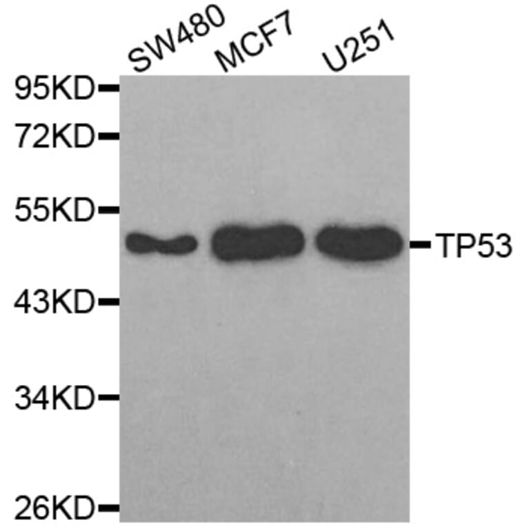 Western blot - TP53 antibody from Signalway Antibody (38624) - Antibodies.com