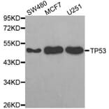 Western blot - TP53 antibody from Signalway Antibody (38624) - Antibodies.com