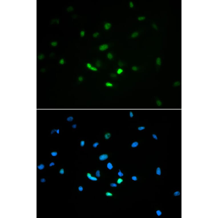 Immunofluorescence - TP53 antibody from Signalway Antibody (38624) - Antibodies.com