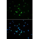 Immunofluorescence - TP53 antibody from Signalway Antibody (38624) - Antibodies.com