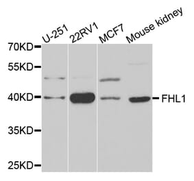 Western blot - FHL1 antibody from Signalway Antibody (38659) - Antibodies.com