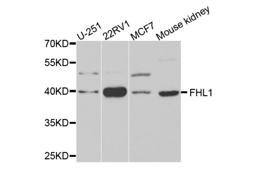 Western blot - FHL1 antibody from Signalway Antibody (38659) - Antibodies.com
