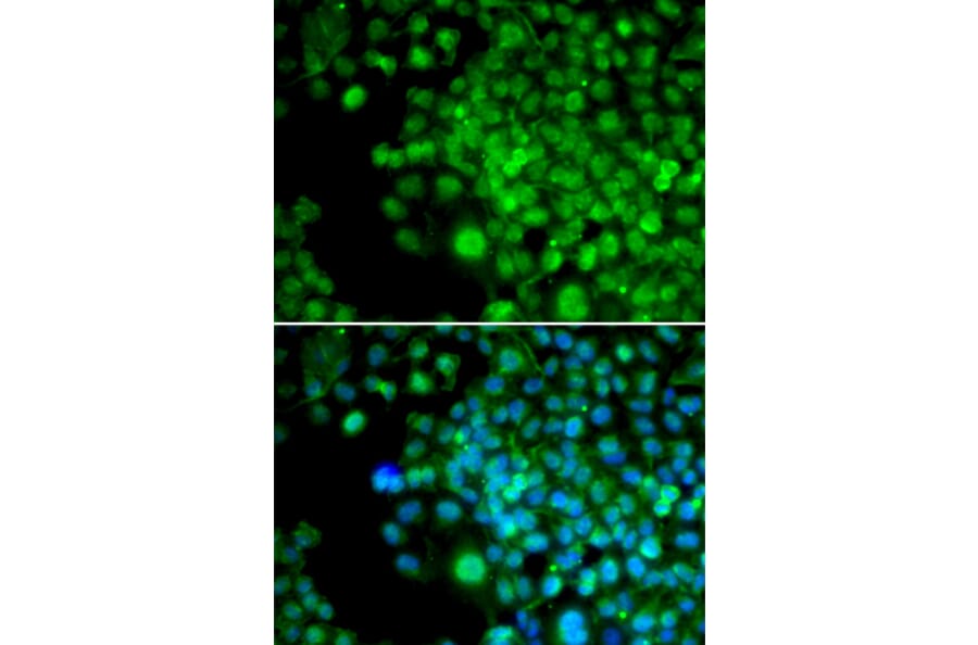 Immunofluorescence - FHL1 antibody from Signalway Antibody (38659) - Antibodies.com