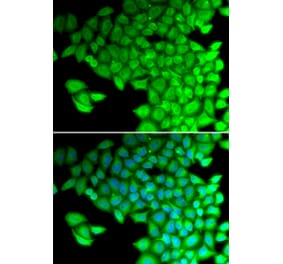 Immunofluorescence - MYL2 antibody from Signalway Antibody (38662) - Antibodies.com