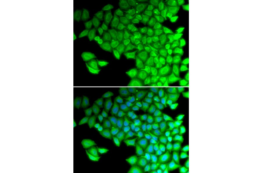 Immunofluorescence - MYL2 antibody from Signalway Antibody (38662) - Antibodies.com