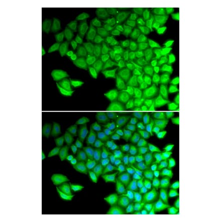 Immunofluorescence - MYL2 antibody from Signalway Antibody (38662) - Antibodies.com