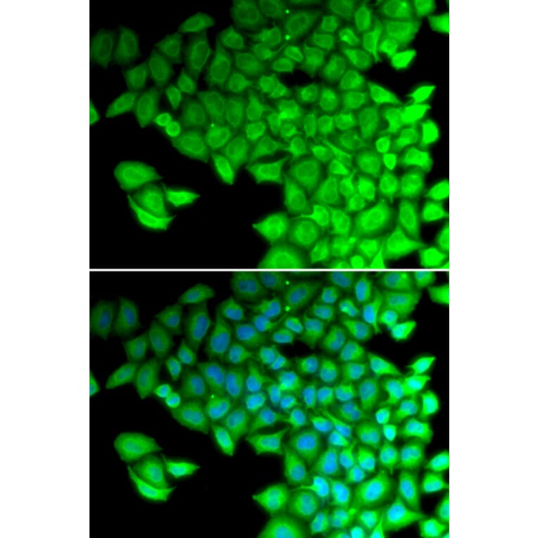Immunofluorescence - MYL2 antibody from Signalway Antibody (38662) - Antibodies.com