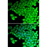 Immunofluorescence - MYL2 antibody from Signalway Antibody (38662) - Antibodies.com