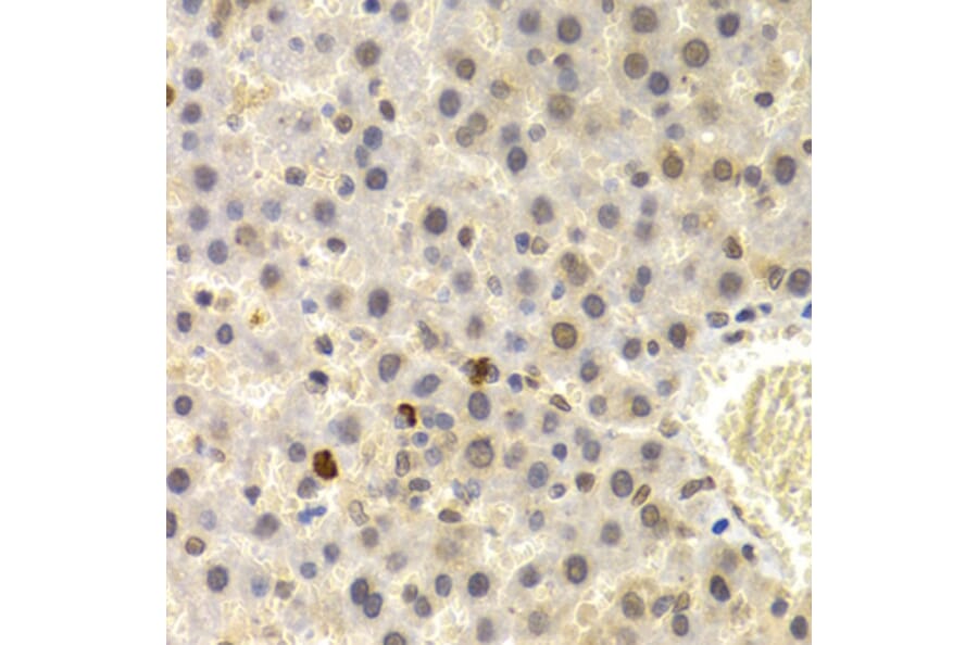 Immunohistochemistry - UMPS antibody from Signalway Antibody (38664) - Antibodies.com