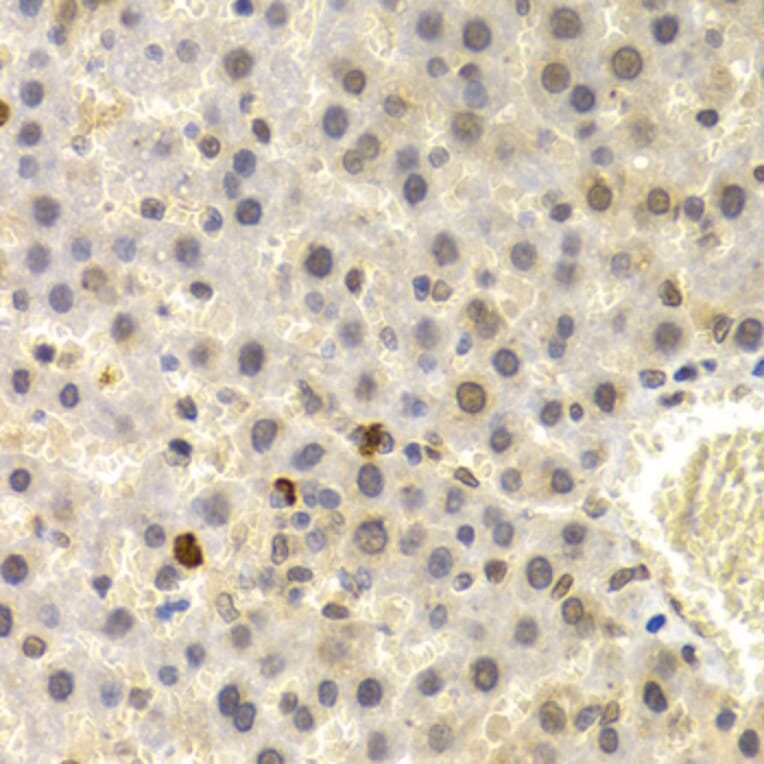Immunohistochemistry - UMPS antibody from Signalway Antibody (38664) - Antibodies.com