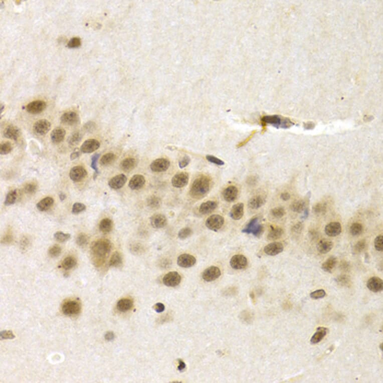 Immunohistochemistry - UMPS antibody from Signalway Antibody (38664) - Antibodies.com