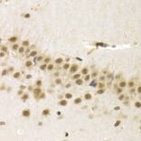 Immunohistochemistry - UMPS antibody from Signalway Antibody (38664) - Antibodies.com