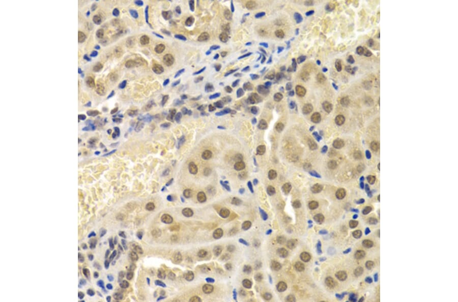 Immunohistochemistry - UMPS antibody from Signalway Antibody (38664) - Antibodies.com